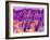 Human Skin, Polarised Light Micrograph-Dr. Keith Wheeler-Framed Photographic Print