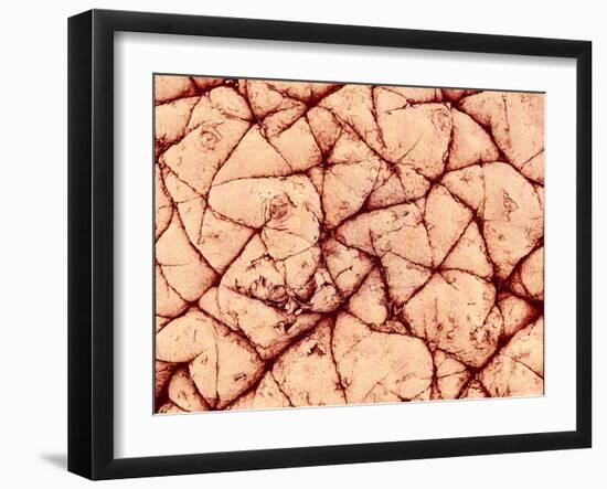 Human Skin Surface, SEM-Susumu Nishinaga-Framed Photographic Print