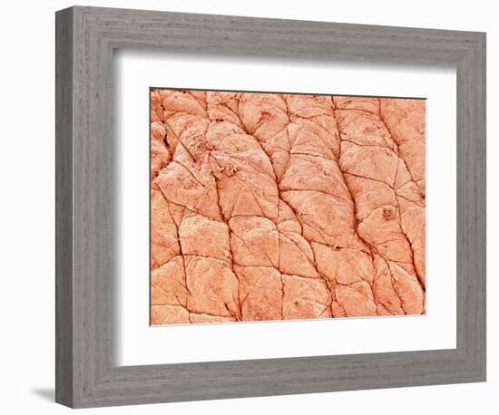 Human Skin-Micro Discovery-Framed Photographic Print
