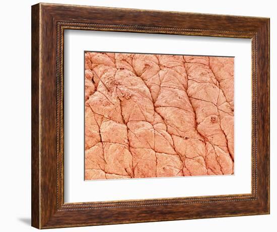 Human Skin-Micro Discovery-Framed Photographic Print