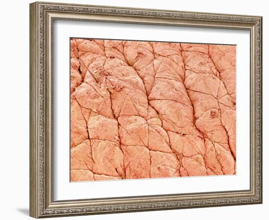 Human Skin-Micro Discovery-Framed Photographic Print