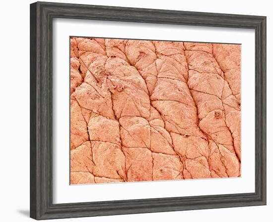 Human Skin-Micro Discovery-Framed Photographic Print