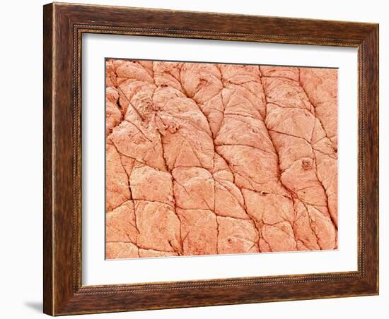 Human Skin-Micro Discovery-Framed Photographic Print