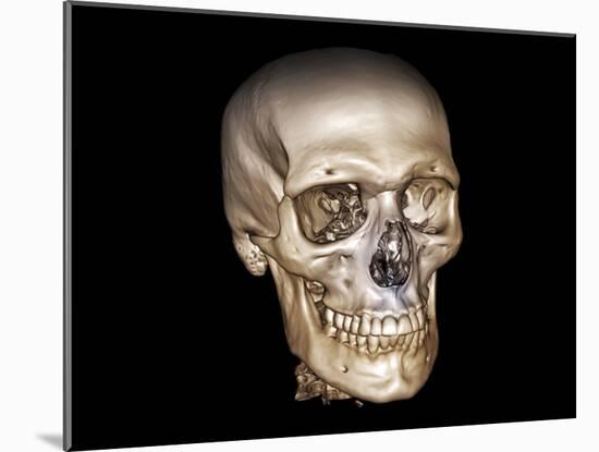 Human Skull, 3D CT Scan-null-Mounted Photographic Print