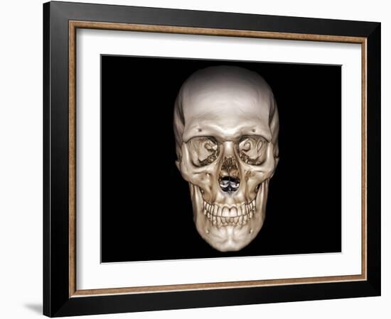 Human Skull, 3D CT Scan-null-Framed Photographic Print