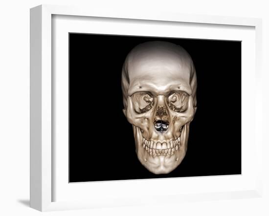 Human Skull, 3D CT Scan-null-Framed Photographic Print