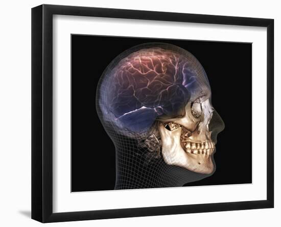 Human Skull and Brain, 3D CT Scan-null-Framed Photographic Print