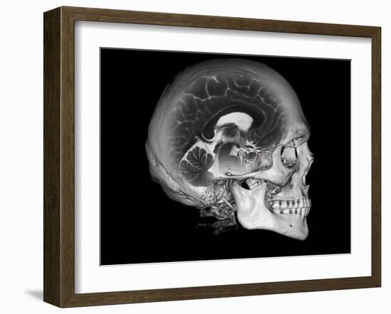 Human Skull and Brain, CT and MRI Scans-null-Framed Photographic Print