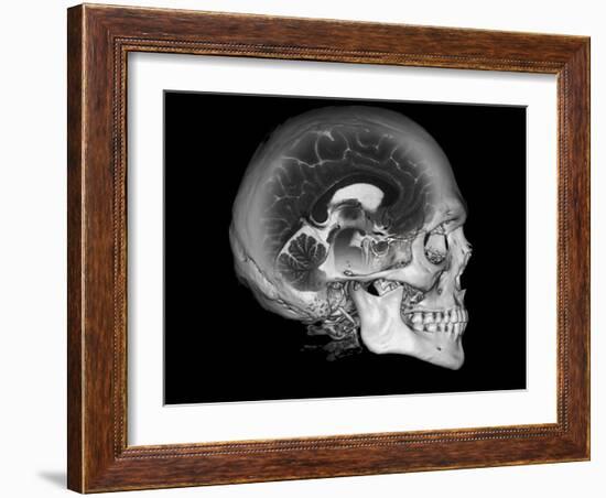 Human Skull and Brain, CT and MRI Scans-null-Framed Photographic Print