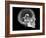 Human Skull and Brain, CT and MRI Scans-null-Framed Photographic Print