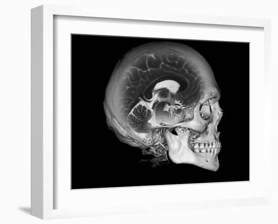 Human Skull and Brain, CT and MRI Scans-null-Framed Photographic Print