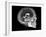 Human Skull and Brain, CT and MRI Scans-null-Framed Photographic Print