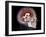 Human Skull and Brain, CT and MRI Scans-null-Framed Photographic Print