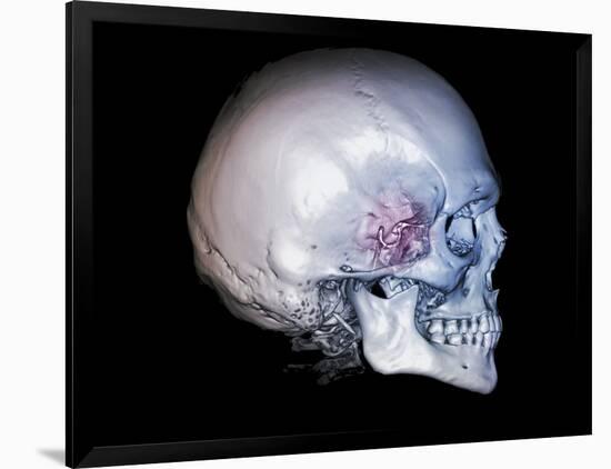 Photographic Print, , large