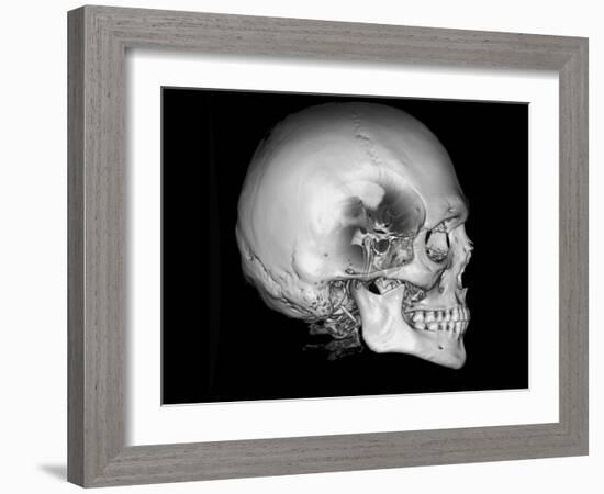 Human Skull and Site of Pituitary Gland, CT and MRI Scans-null-Framed Photographic Print