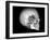 Human Skull and Site of Pituitary Gland, CT and MRI Scans-null-Framed Photographic Print
