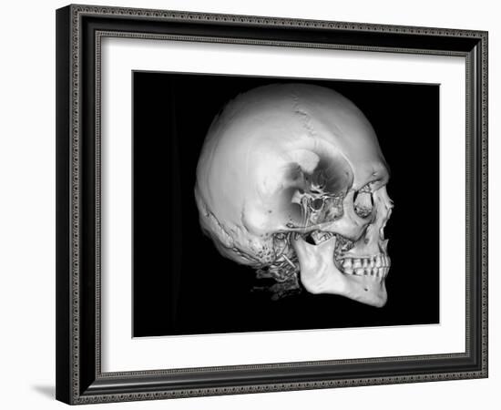 Human Skull and Site of Pituitary Gland, CT and MRI Scans-null-Framed Photographic Print