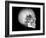 Human Skull and Site of Pituitary Gland, CT and MRI Scans-null-Framed Photographic Print