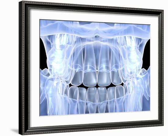 Human Skull with Teeth, Computer Artwork-PASIEKA-Framed Photographic Print