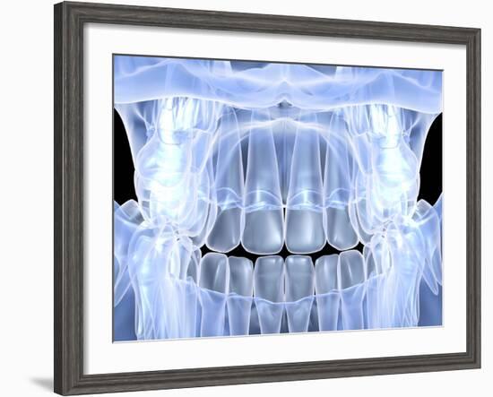 Human Skull with Teeth, Computer Artwork-PASIEKA-Framed Photographic Print