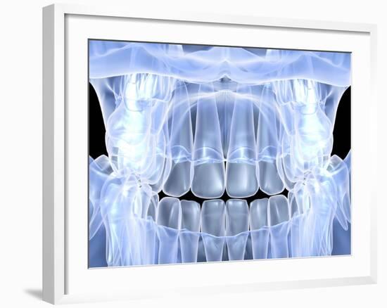 Human Skull with Teeth, Computer Artwork-PASIEKA-Framed Photographic Print