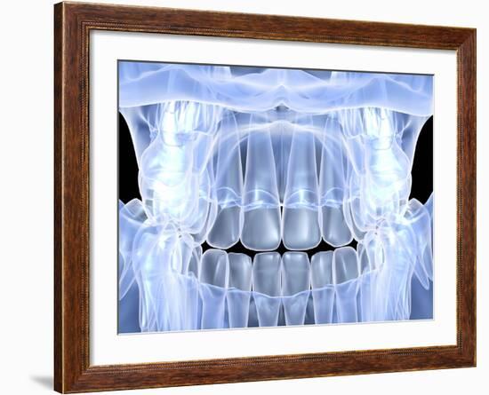 Human Skull with Teeth, Computer Artwork-PASIEKA-Framed Photographic Print