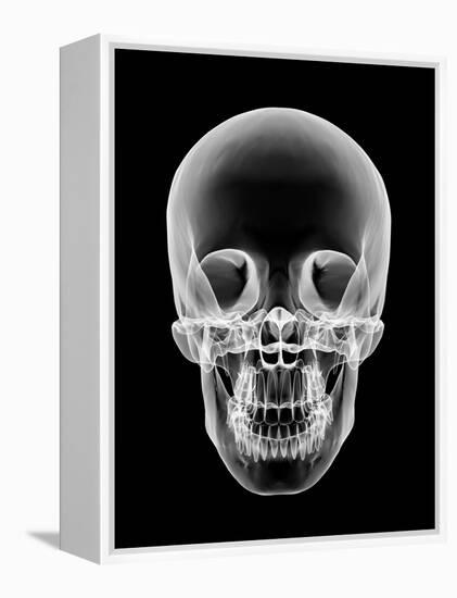 Human Skull, X-ray Artwork-PASIEKA-Framed Premier Image Canvas