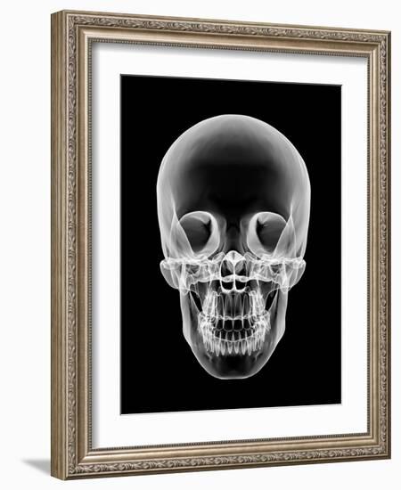 Human Skull, X-ray Artwork-PASIEKA-Framed Photographic Print