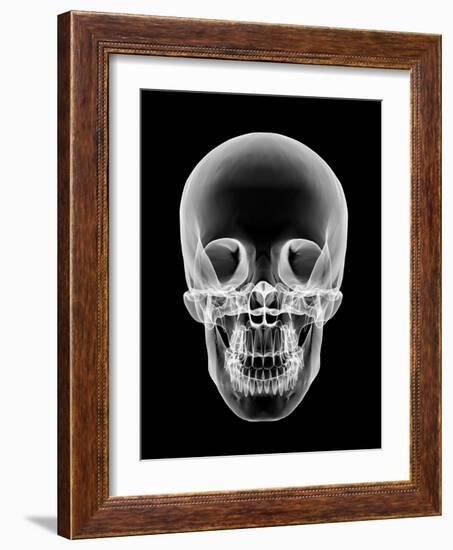 Human Skull, X-ray Artwork-PASIEKA-Framed Photographic Print