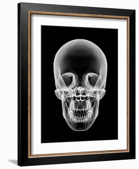 Human Skull, X-ray Artwork-PASIEKA-Framed Photographic Print