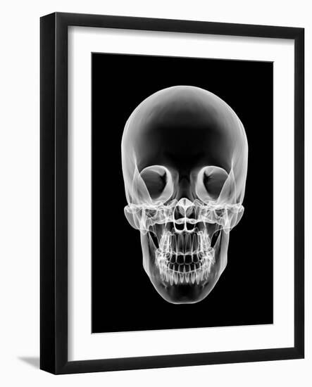 Human Skull, X-ray Artwork-PASIEKA-Framed Photographic Print