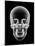 Human Skull, X-ray Artwork-PASIEKA-Mounted Photographic Print