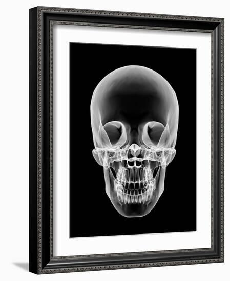 Human Skull, X-ray Artwork-PASIEKA-Framed Photographic Print