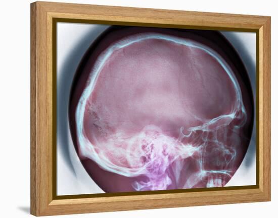 Human Skull, X-ray-Du Cane Medical-Framed Premier Image Canvas