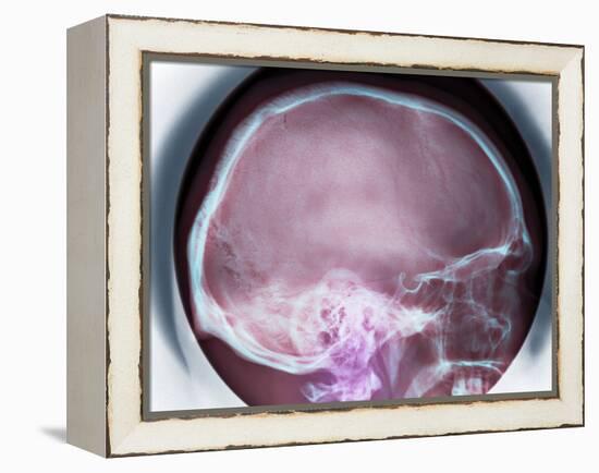 Human Skull, X-ray-Du Cane Medical-Framed Premier Image Canvas