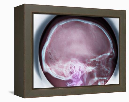 Human Skull, X-ray-Du Cane Medical-Framed Premier Image Canvas