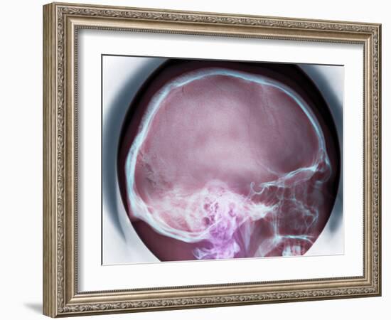 Human Skull, X-ray-Du Cane Medical-Framed Photographic Print