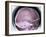 Human Skull, X-ray-Du Cane Medical-Framed Photographic Print