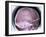 Human Skull, X-ray-Du Cane Medical-Framed Photographic Print