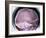 Human Skull, X-ray-Du Cane Medical-Framed Photographic Print