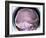 Human Skull, X-ray-Du Cane Medical-Framed Photographic Print