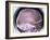 Human Skull, X-ray-Du Cane Medical-Framed Photographic Print