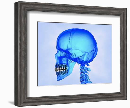 Human Skull-Matthias Kulka-Framed Giclee Print