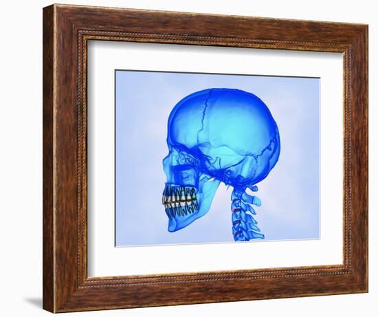 Human Skull-Matthias Kulka-Framed Giclee Print