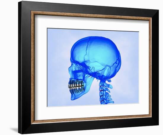 Human Skull-Matthias Kulka-Framed Giclee Print