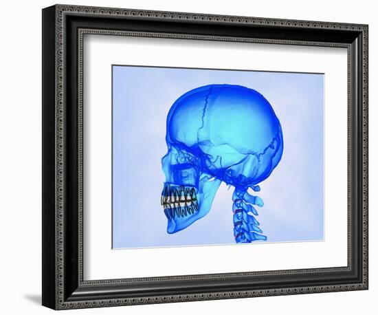 Human Skull-Matthias Kulka-Framed Giclee Print