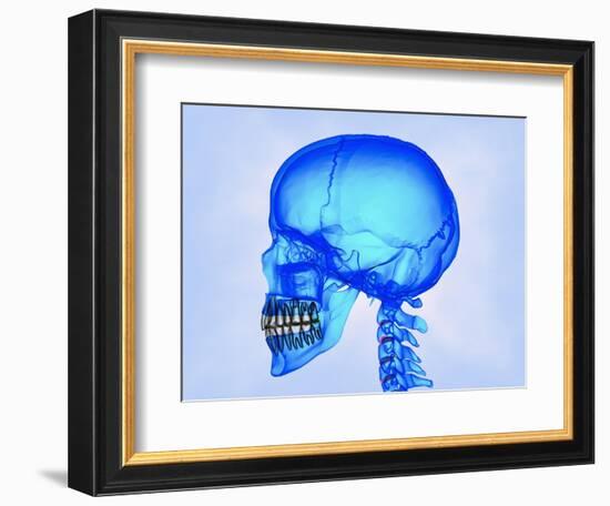 Human Skull-Matthias Kulka-Framed Giclee Print