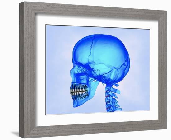 Human Skull-Matthias Kulka-Framed Giclee Print