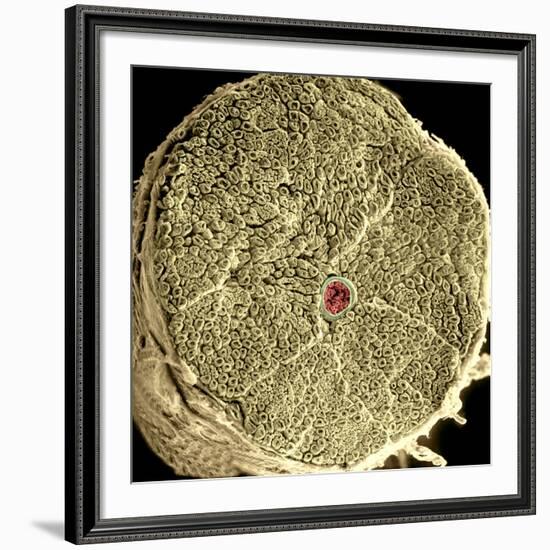 Human Spinal Nerve, SEM-Thomas Deerinck-Framed Photographic Print