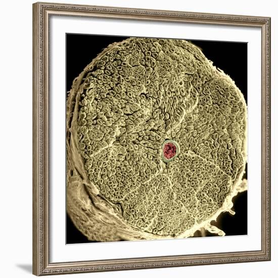 Human Spinal Nerve, SEM-Thomas Deerinck-Framed Photographic Print